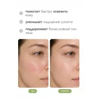Эссенция-тоник против купероза и покраснений
